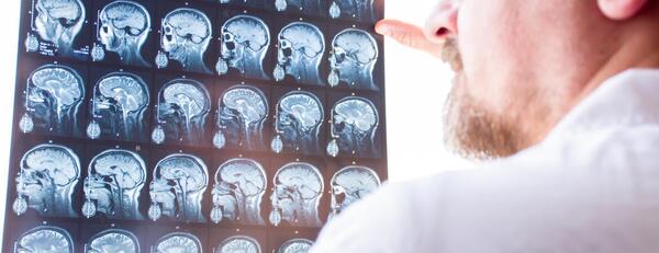 Image of medical personnel looking at a CT scan of a person's skull and brain